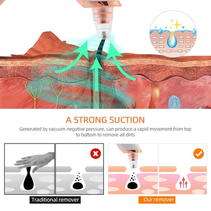 Aspirateur Points Noirs Visage