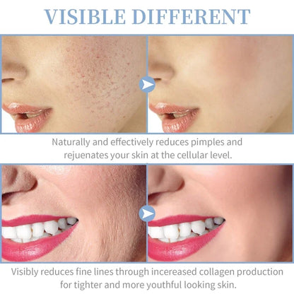 "Appareil Visage 4-en-1 Haute Fréquence Portable"